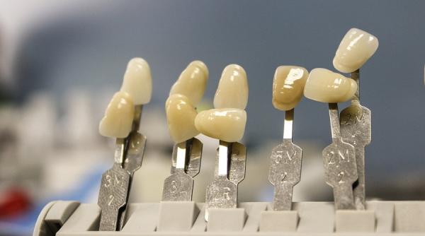 solutii ieftine implant dentar dr alice gavrilescu exista metode moderne