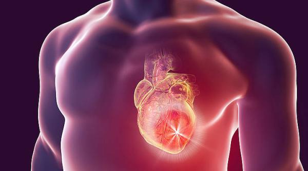 infarct miocardic celulele stem ombilicale la recuperarea inimii