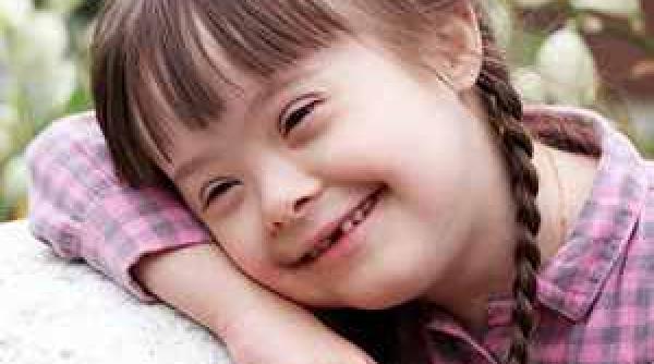 sindromul down ar putea fi reversibil descoperire noua