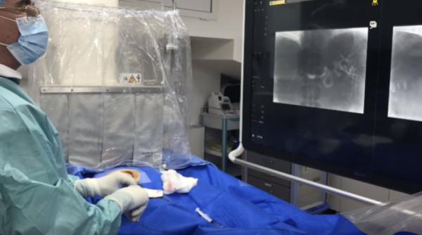 radiologul interventionist bogdan popa navigam in interiorul vaselor exclusiv