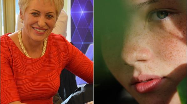 cum scapi de petele maronii si pistrui lidia fecioru leac miraculos