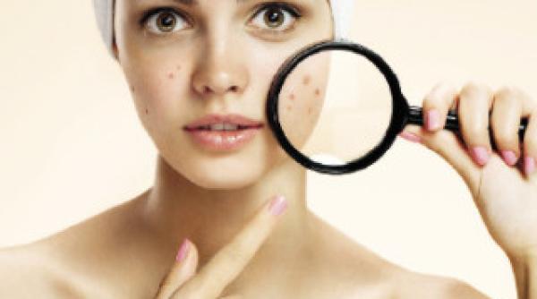 pielea cum o protejezi in vara asta explicatiile dermatologului