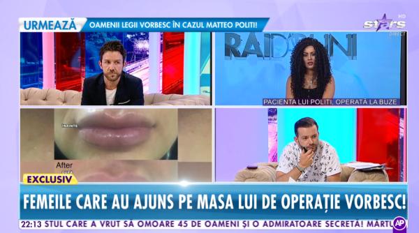 matteo politi fata in fata cu o pacienta mutilata la tv