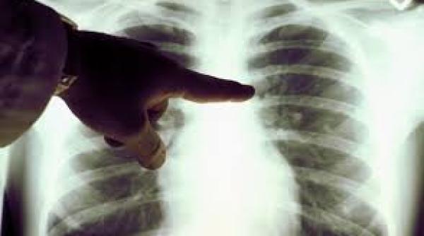 poluarea aerului la fel de periculoasa ca fumatul unui pachet de tigari pe zi impact sever