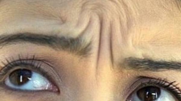 cinci alimente care te fac sa imbatranesti mai repede