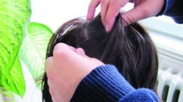 trei remedii simple care te scapa de paduchi