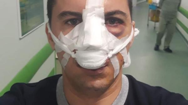 politisti agresati valcea mesaj al sindicatului europol