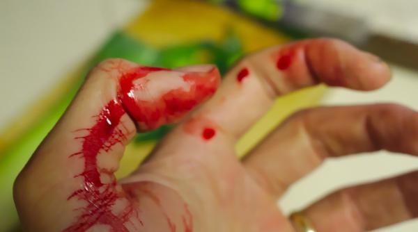 prim ajutor mituri care ti fac rau ce faci cand te arzi ingheti sau te ranesti