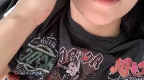 irina rimes in spital operata de urgenta