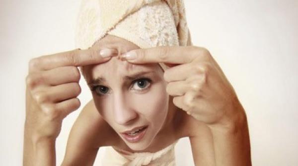 reteta cu lamaie si bicarbonat pentru cosuri rezultate fantastice