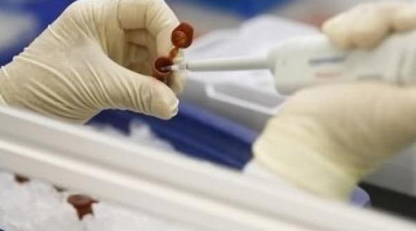 cancer prostata cand trebuie sa mergi la control dr bogdan parliteanu sanador lucrurile s au schimbat e obligatoriu