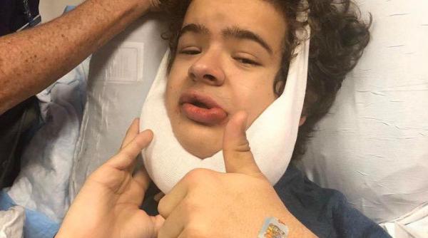 actorul din stranger things nu are dintii frontali boala care l a distrus