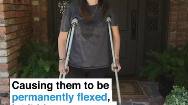 o femeie merge dupa 15 ani si multe operatii