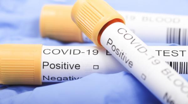 testare rapida coronavirus pentru toti pacientii ok medical