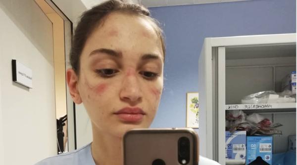 urmele pandemiei de covid 19 asistenta medicala din milano mi e teama noi tinerii nu suntem imuni la coronavirus