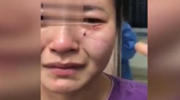 covid 19 o asistenta din china a fost muscata de fata de un pacient infectat