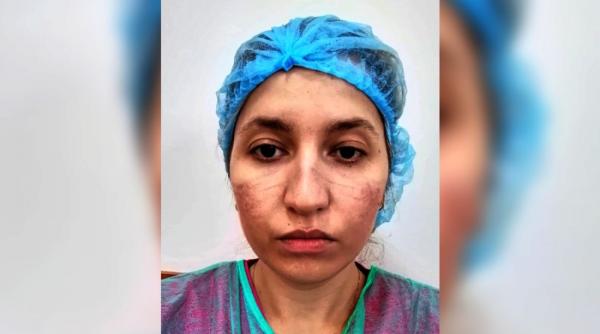 medic rezident la spitalul obregia mesaj pentru romani asa arata fata mea nu va mai bateti joc de noi foto