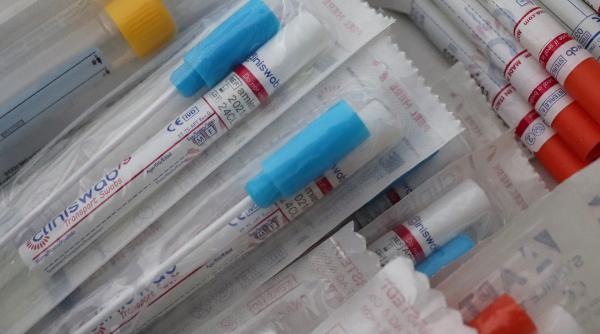 cel mai rapid test pentru covid 19 rezultatul in doar 20 minute