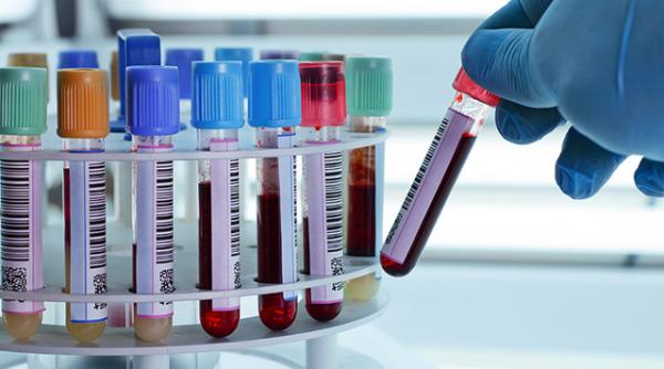 veste buna pentru romania vin medicamente de top in tratamentul covid 19