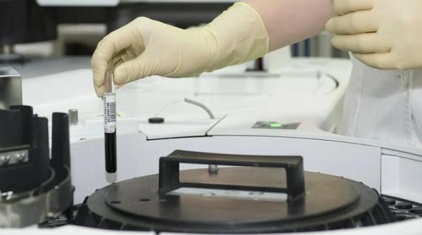 coronavirusul are transmise sexuala studiul recent din china