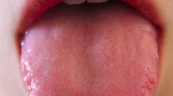 testul de covid 19 care se poate cumpara usor rezultat in 10 minute si nu doare