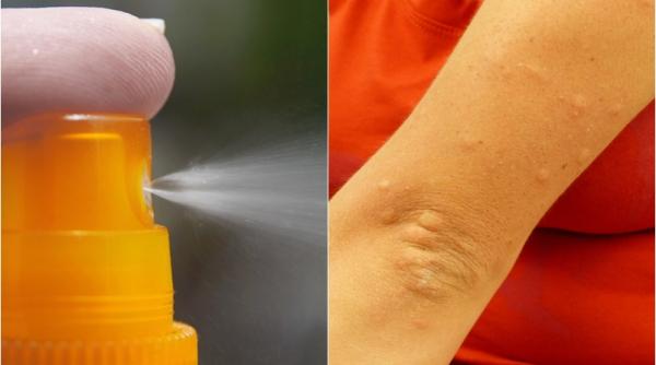 cum sa ti faci spray natural anti tantari ingredientul care i pune pe fuga se aplica direct pe piele