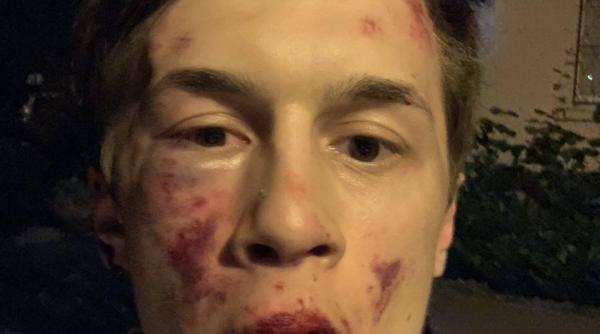 rusia incearca sa i reduca la tacere pe opozanti un jurnalist critic la adresa kremlinului a fost crunt batut