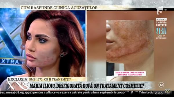 maria ilioiu desfigurata de un estetician gheorghe borcean presedintele consiliului medicilor acea persoana este pasibila de inchisoare