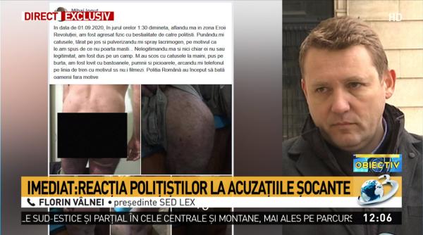 barbat batut pe camp de politisti vilnei tind sa cred ca sunt anumite lucruri adevarate