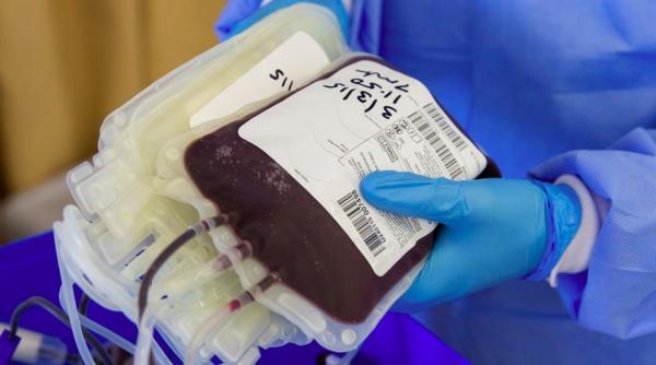 proteina din sange care te face vulnerabil in fata covid 19 reduci nivelul ei cu un obicei simplu si zilnic