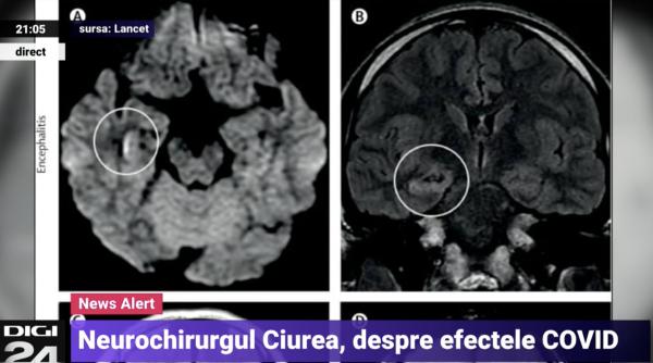 microb care se hraneste cu creierul uman descoperit in reteaua cu apa a unui oras