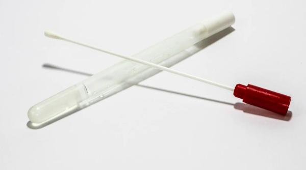 ministerul sanatatii lamuriri dupa recordul de teste facute in romania