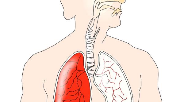 cum iti cureti plamanii de tutun 7 ingrediente naturale care te ajuta