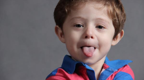 covid 19 aduce modificari la nivelul gurii o limba umflata poate fi un simptom de infectare