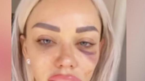 bianca dragusanu acuza ca a fost desfigurata in bataie de alex bodi am fost snopita doi ani si jumatate replica fostului sot