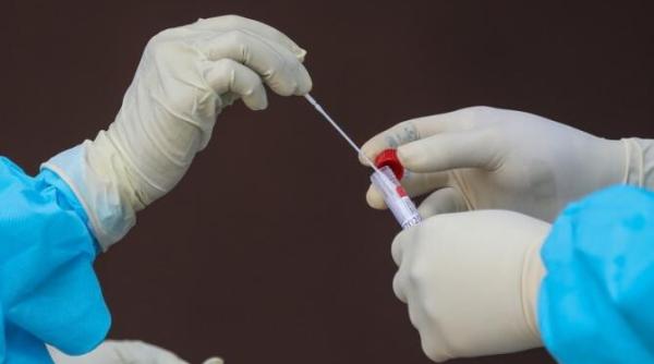 de ce astrazeneca are eficienta 60prc in timp ce pfizer si moderna au peste 95prc cncav raspunde