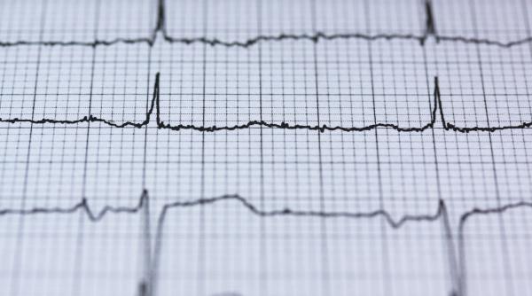 copac bolile cardiovasculare nu asteapta sa treaca pandemia mergi la medic