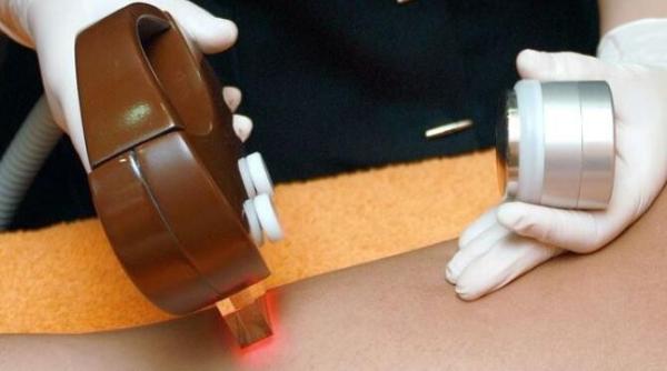 care sunt efectele negative ale epilarii definitive medicii avertizeaza