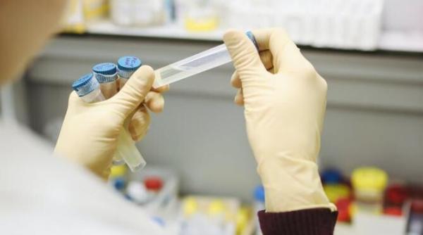 medicul adriana pistol despre testele pe baza de saliva sigur ca nu interzicem este important sa stim cum sa le interpretam