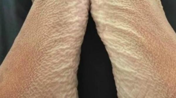 foto o femeie a stat 16 ore in cada facandu si picioarele praf