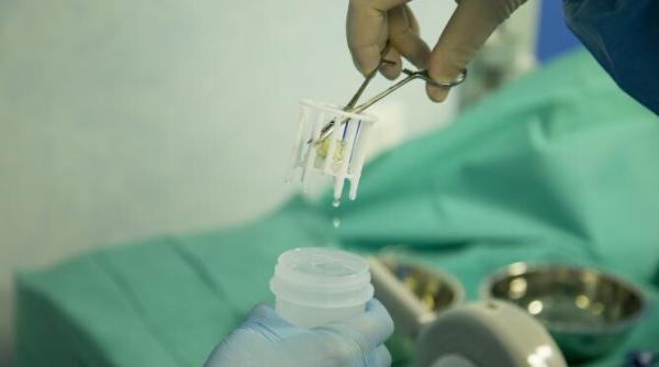 o femeie care avea inima in partea dreapta a primit o proteza de valva aortica prin intermediul arterelor la ares procedura tavi o sansa pentru pacientii inoperabili