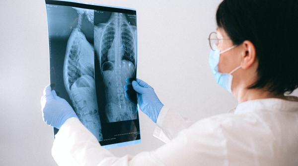 cancer pulmonar  fumator vs nefumator  dr  cristina popescu  genele noastre sunt doar o parte din raspuns