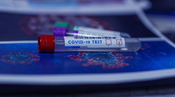 86 de cazuri detectate pozitiv luni in scoli  dupa prima zi de utilizare a testelor rapide antigen