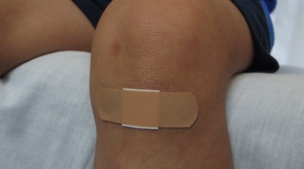 ce se pune pe rana sa se vindece mai repede trucuri simple pentru tratarea leziunilor usoare