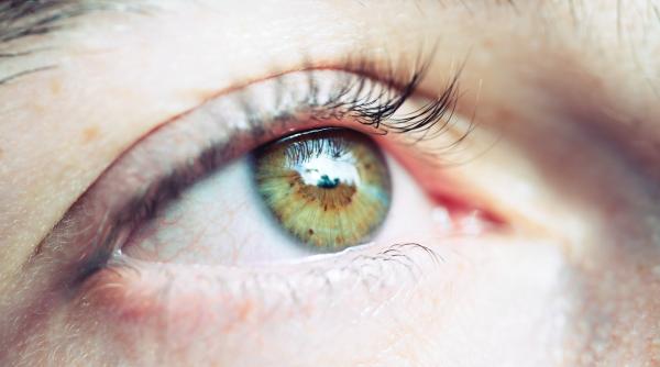 de ce se sparg vasele de sange la ochi cauzele hemoragiei subconjunctivale si cand ar trebui sa mergi la medic