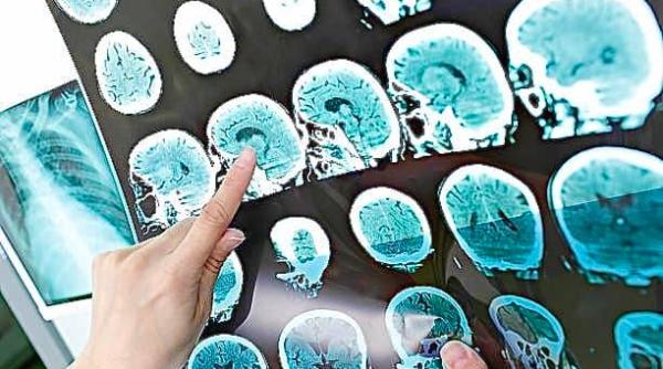 costel fotea la galati primul centru de tratare a sclerozei multiple din regiune