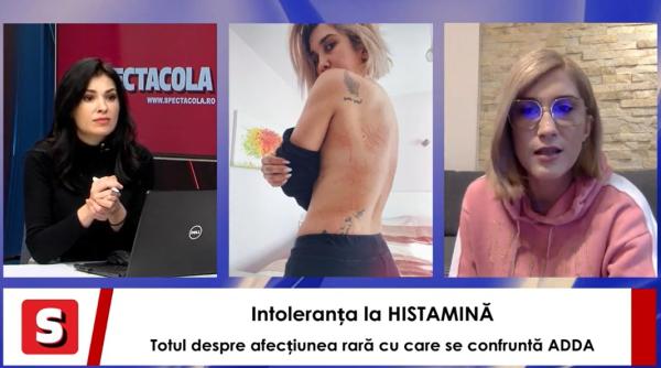 intoleranta la histamina totul despre boala rara cu care a fost diagnosticata adda interviurile spectacola
