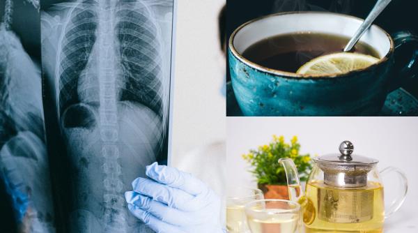 bautura minune care curata si vindeca plamanii si calmeaza tusea efect antiinflamator daca te ai lasat de fumat trebuie sa o bei