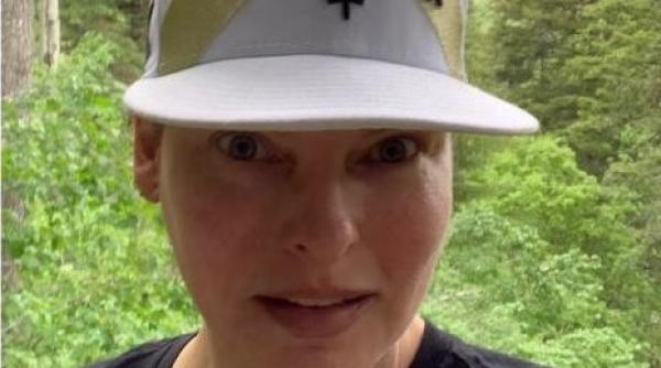 linda evangelista primele imagini cu corpul deformat de procedurile estetice nu ma mai ascund am ramas asa cum ma descria presa de nerecunoscut