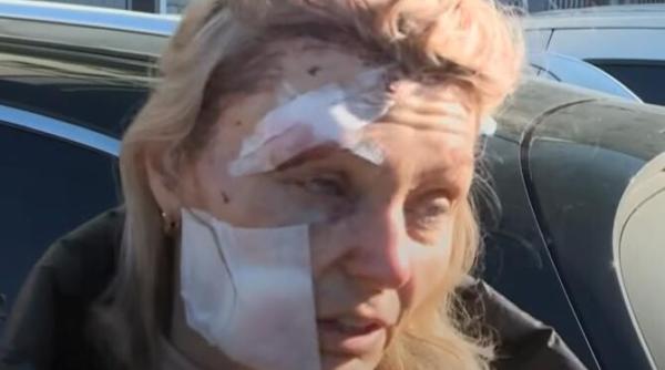 drama civililor din ucraina am studiat istoria dar nu m am gandit niciodata ca asta se va intampla